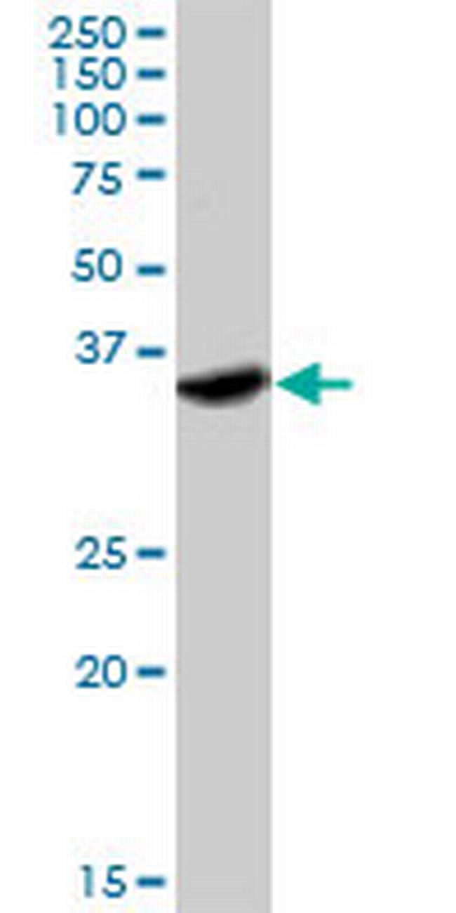 IFNGR2 Antibody in Western Blot (WB)