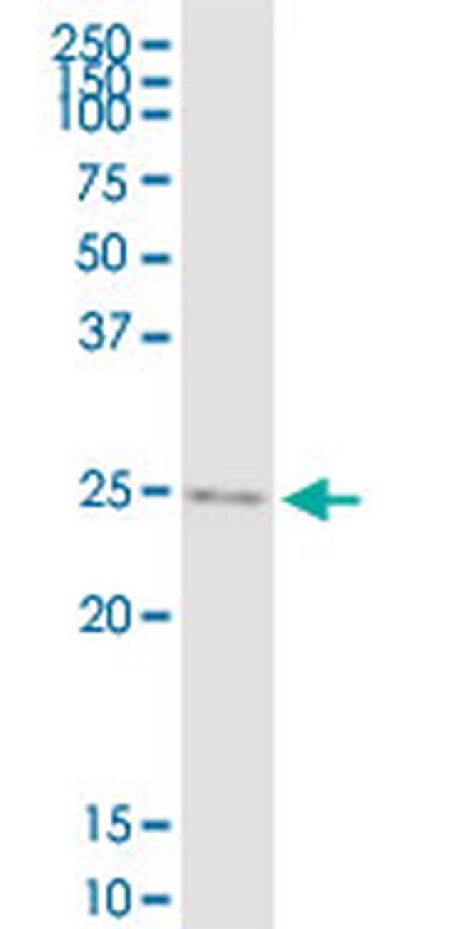 IGF2 Antibody in Western Blot (WB)
