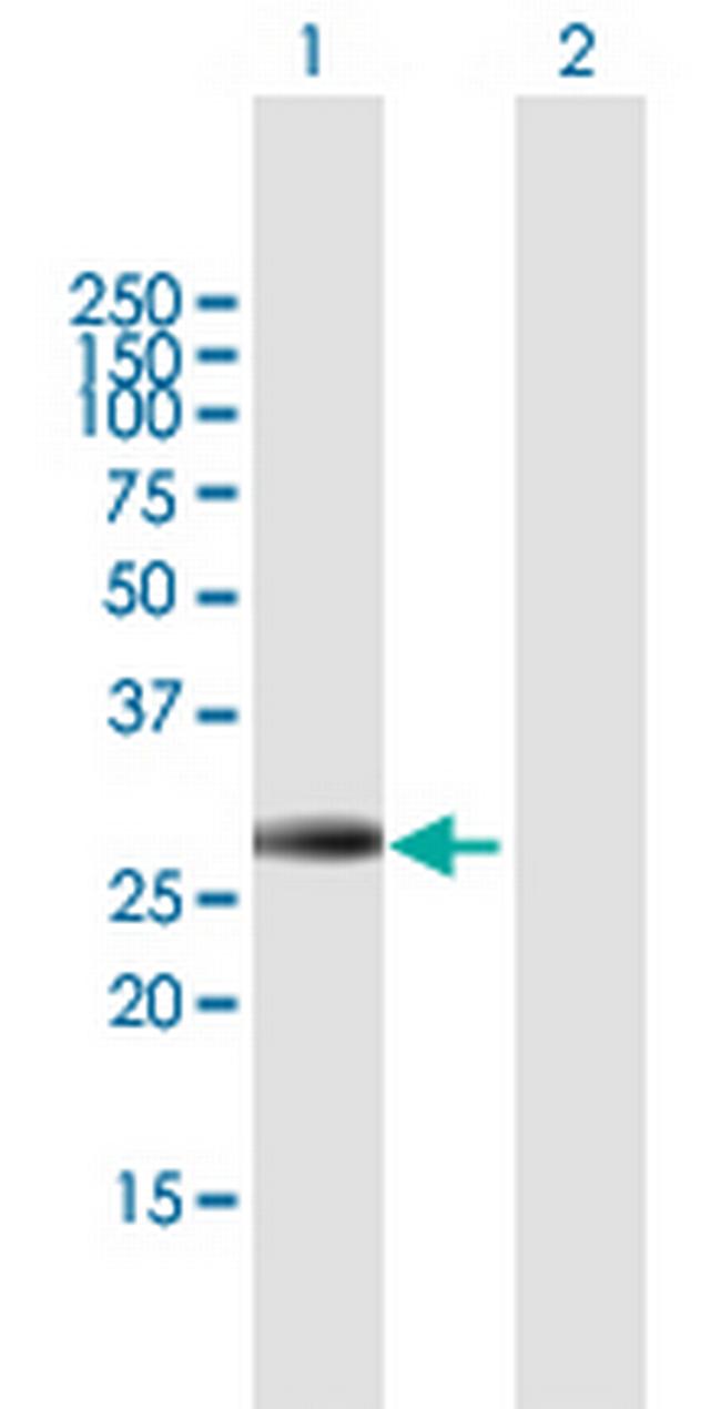 IGFBP4 Antibody in Western Blot (WB)
