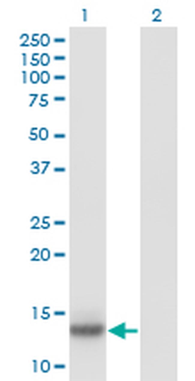 IL2 Antibody in Western Blot (WB)