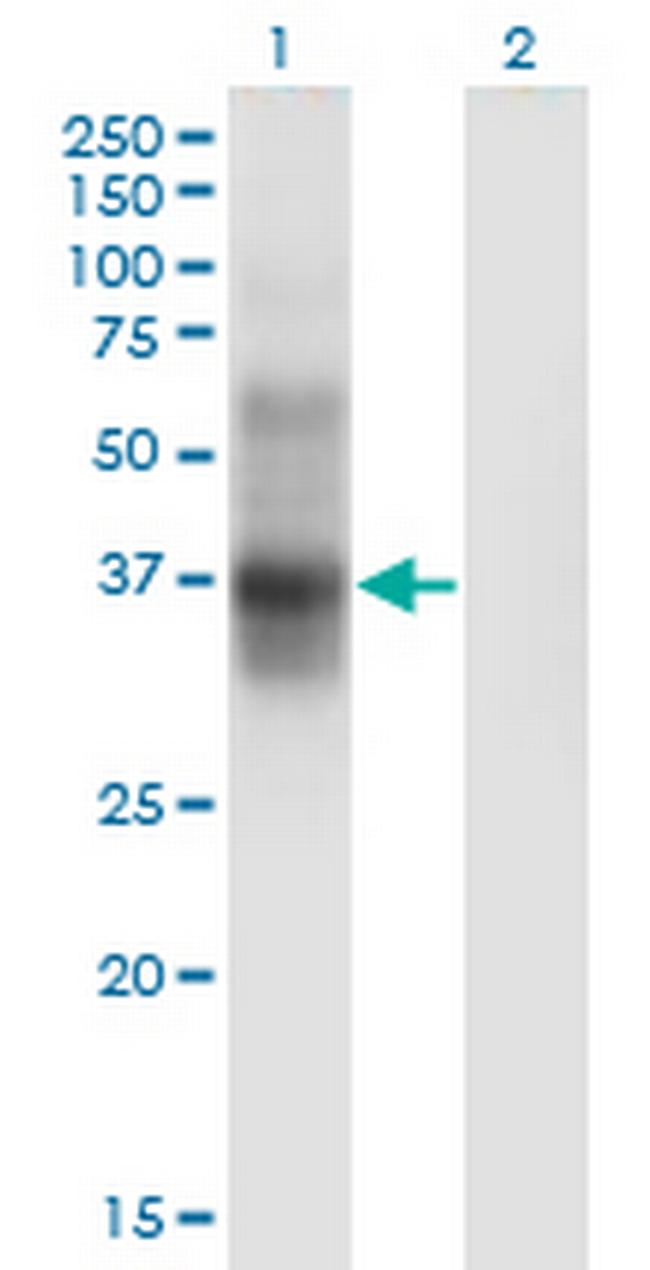 IL2RA Antibody in Western Blot (WB)