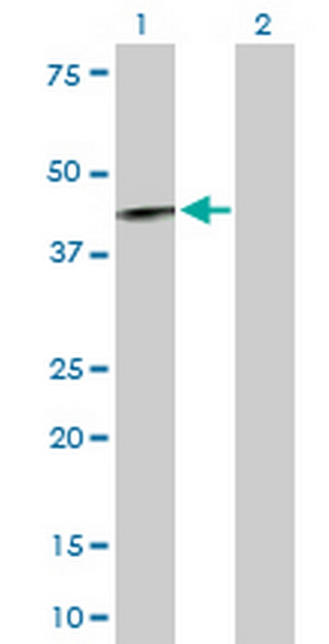 IL12RB1 Antibody in Western Blot (WB)