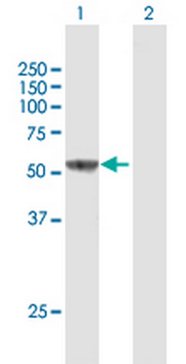 IL16 Antibody in Western Blot (WB)