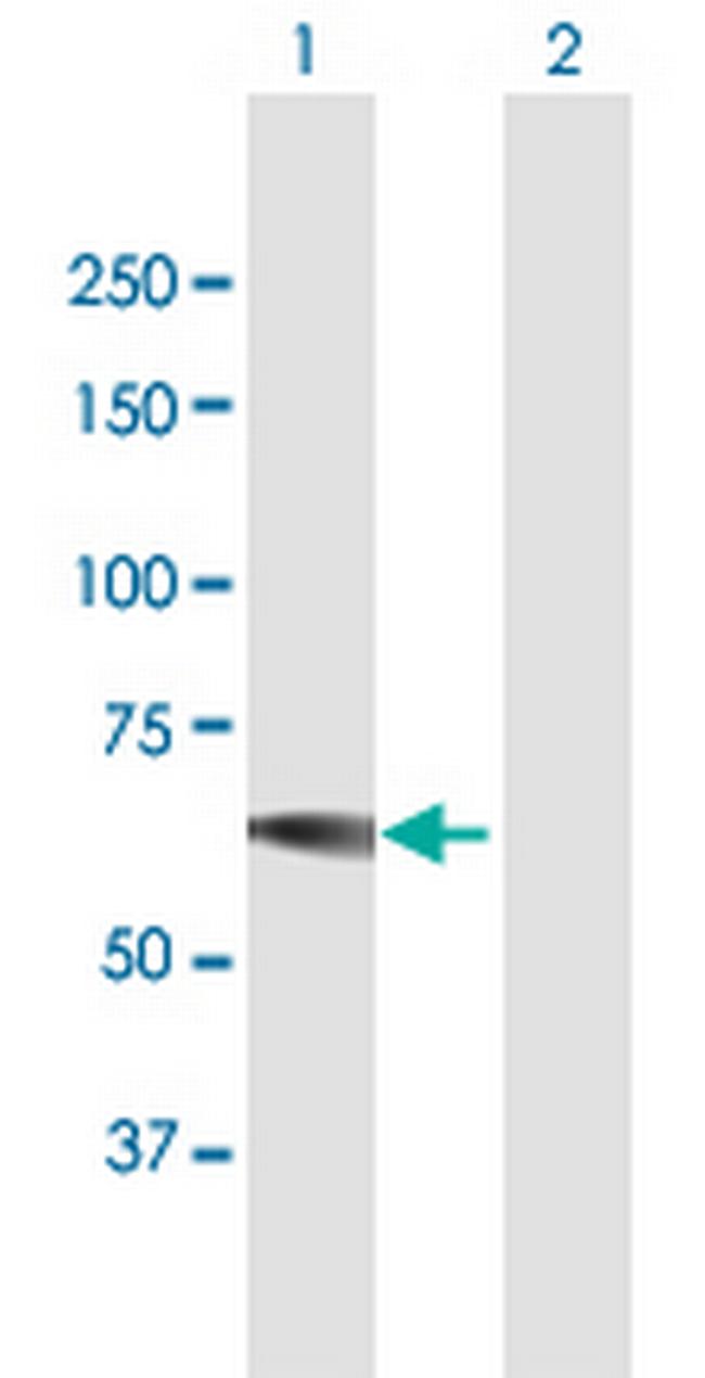 IMPDH1 Antibody in Western Blot (WB)