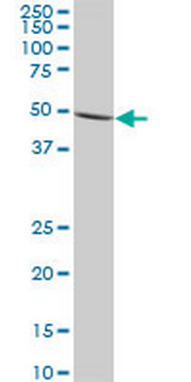 IMPDH1 Antibody in Western Blot (WB)