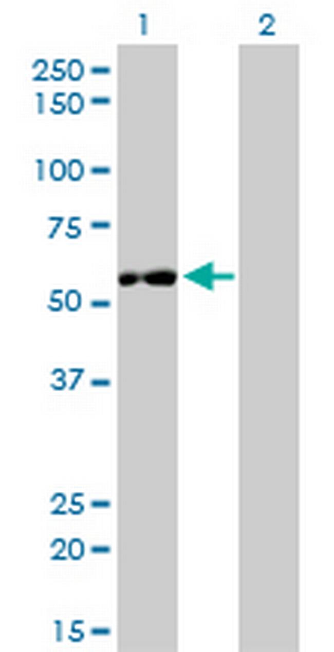 IMPDH2 Antibody in Western Blot (WB)