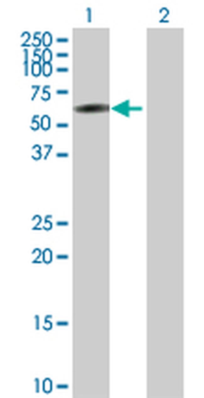 IRF2 Antibody in Western Blot (WB)