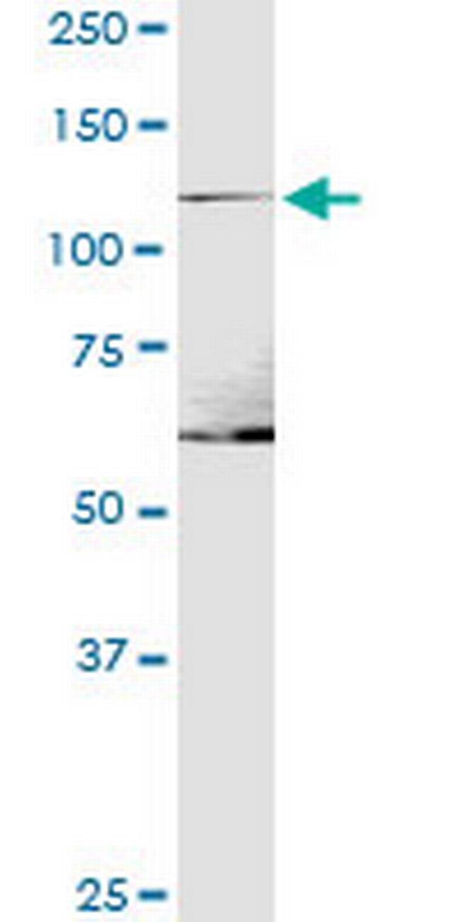 ITGA1 Antibody in Western Blot (WB)