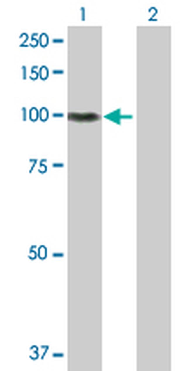 ITGB5 Antibody in Western Blot (WB)