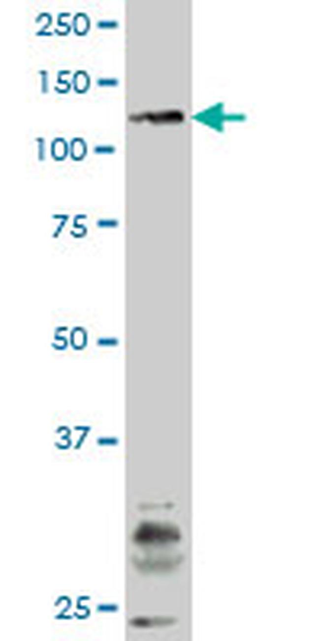 JAK3 Antibody in Western Blot (WB)