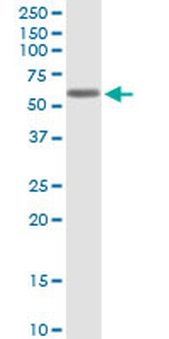 KCNA1 Antibody in Western Blot (WB)