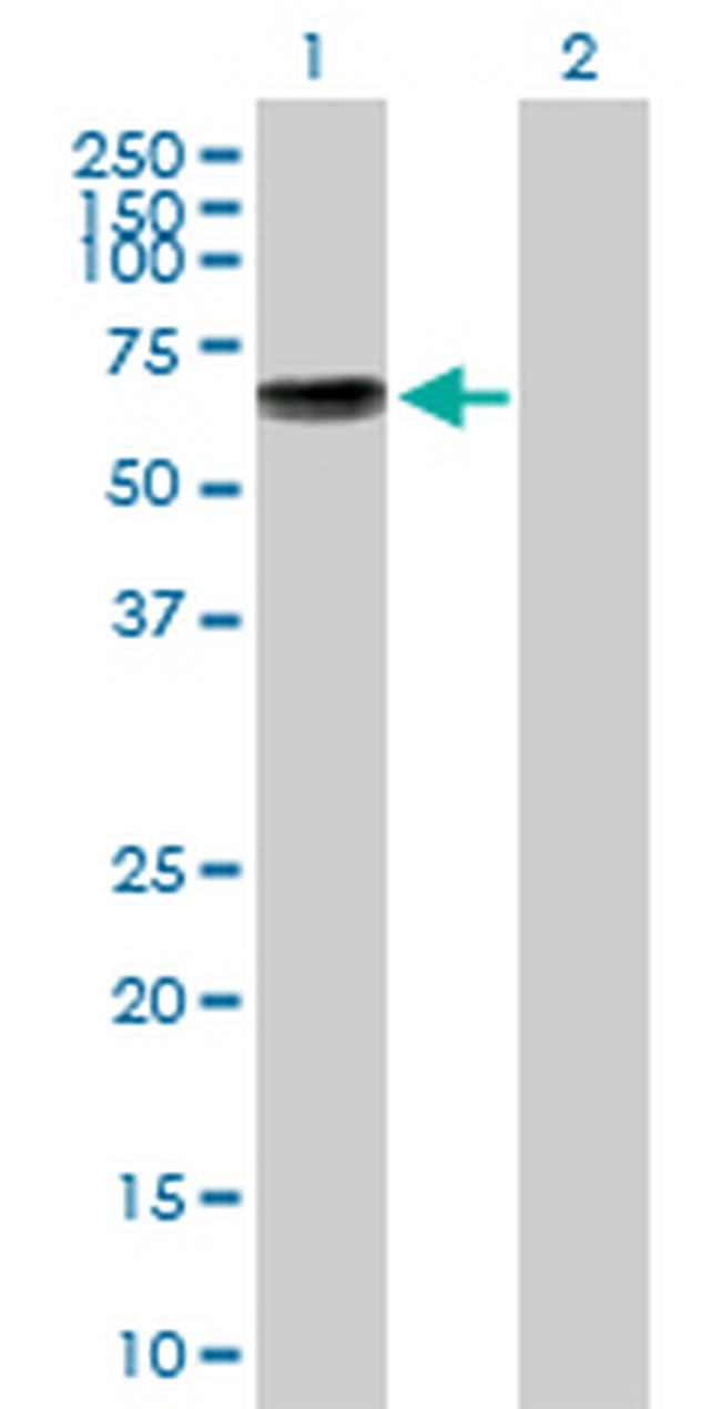 KCNA1 Antibody in Western Blot (WB)