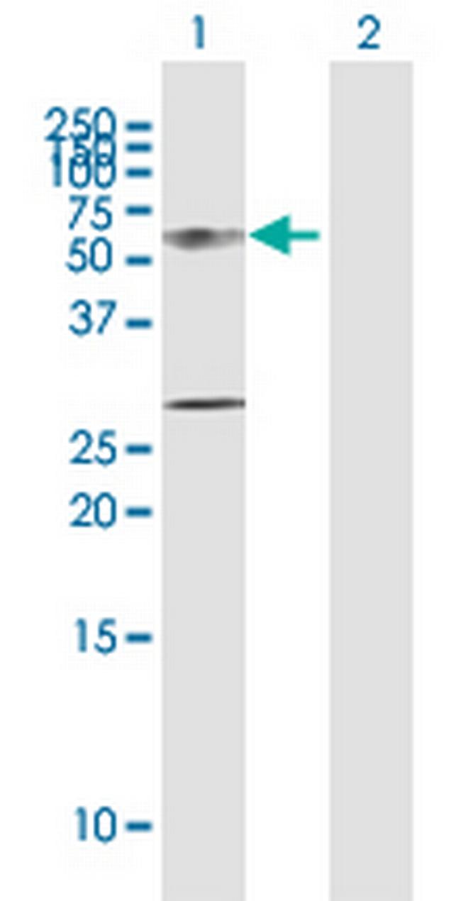 KRT12 Antibody in Western Blot (WB)