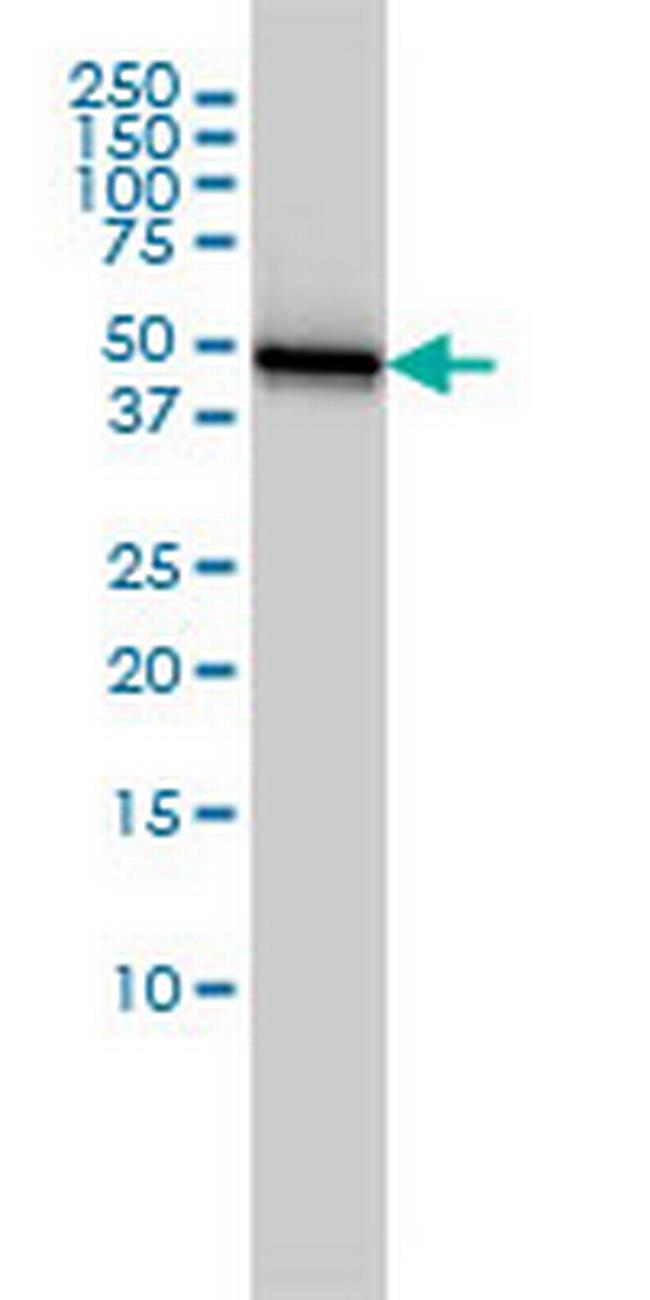 KRT18 Antibody in Western Blot (WB)