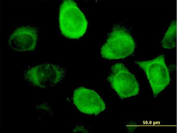 KRT18 Antibody in Immunocytochemistry (ICC/IF)