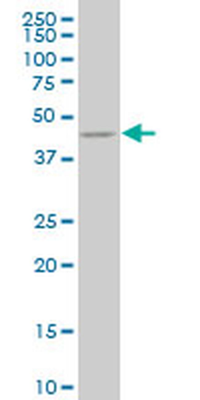 KRT18 Antibody in Western Blot (WB)