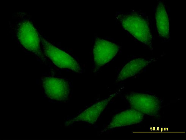 LIMK2 Antibody in Immunocytochemistry (ICC/IF)