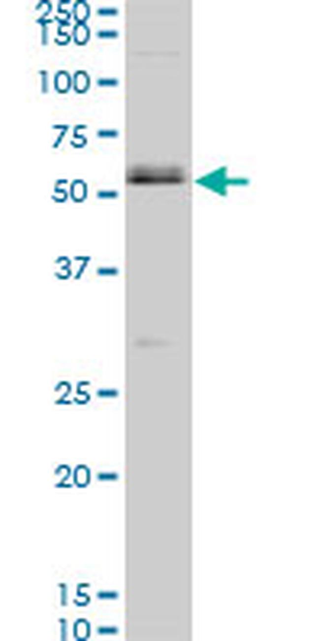 SMAD1 Antibody in Western Blot (WB)