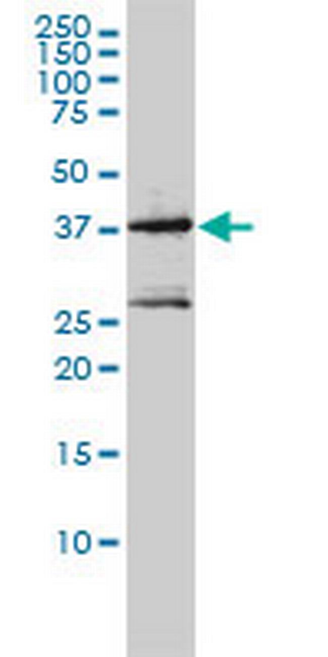 MAGEA2 Antibody in Western Blot (WB)