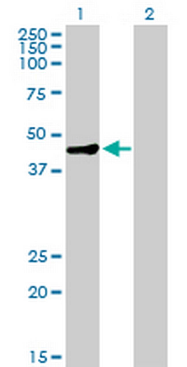 MAGEA9 Antibody in Western Blot (WB)