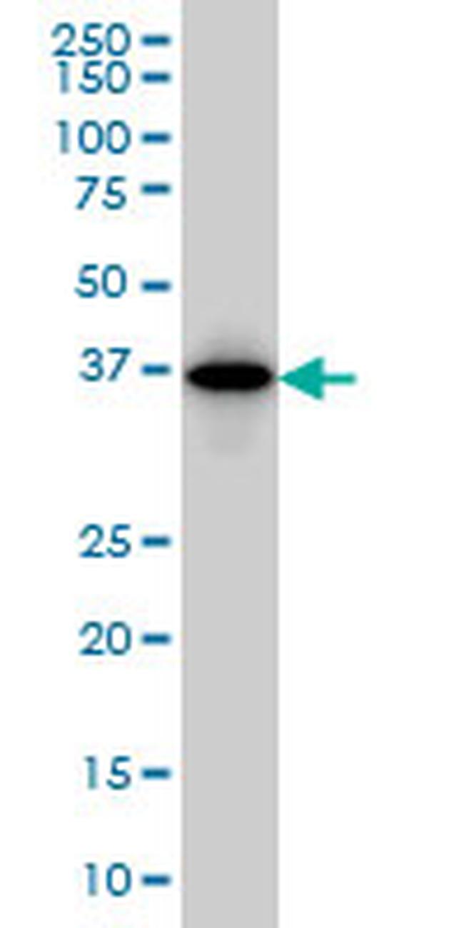 MAGEA9 Antibody in Western Blot (WB)