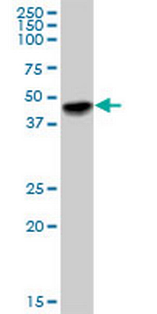 MAGEA12 Antibody in Western Blot (WB)