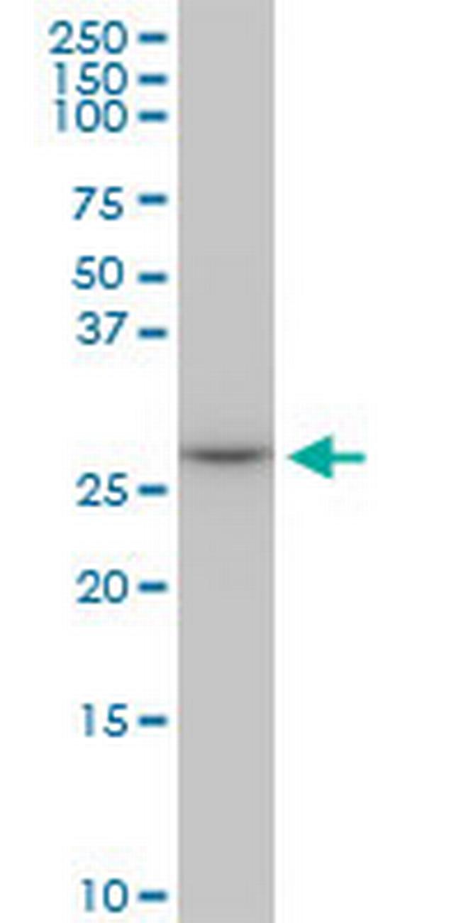 MAGEA12 Antibody in Western Blot (WB)