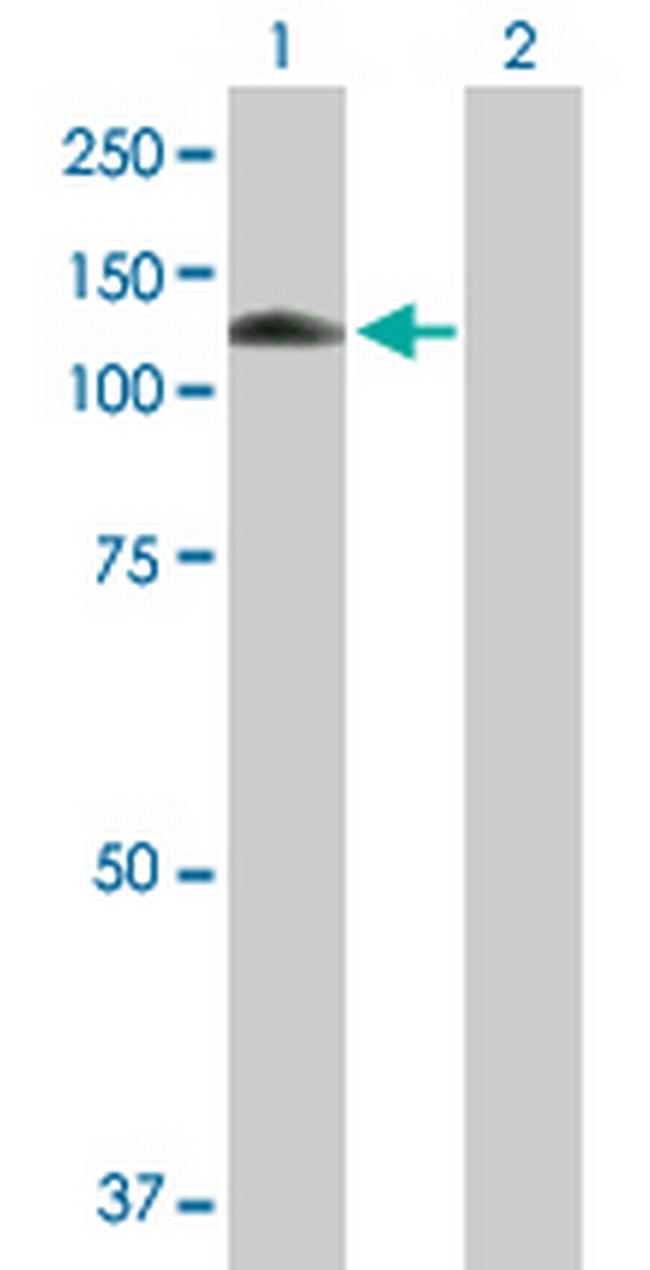 MANBA Antibody in Western Blot (WB)