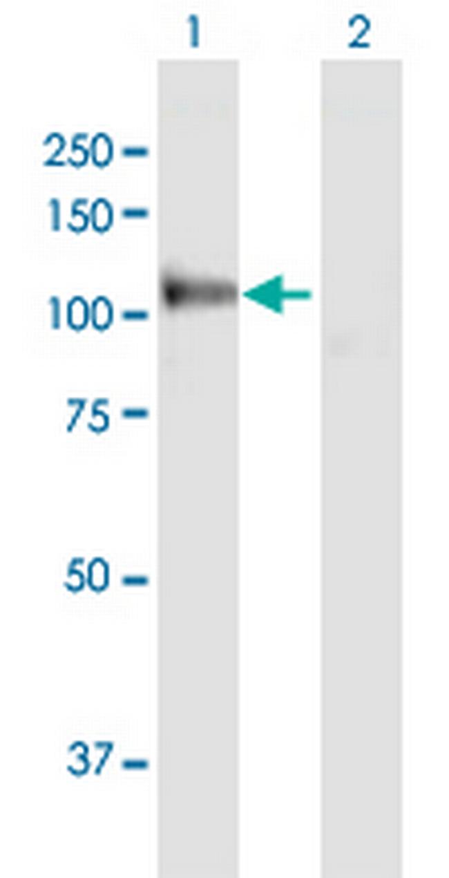 MANBA Antibody in Western Blot (WB)