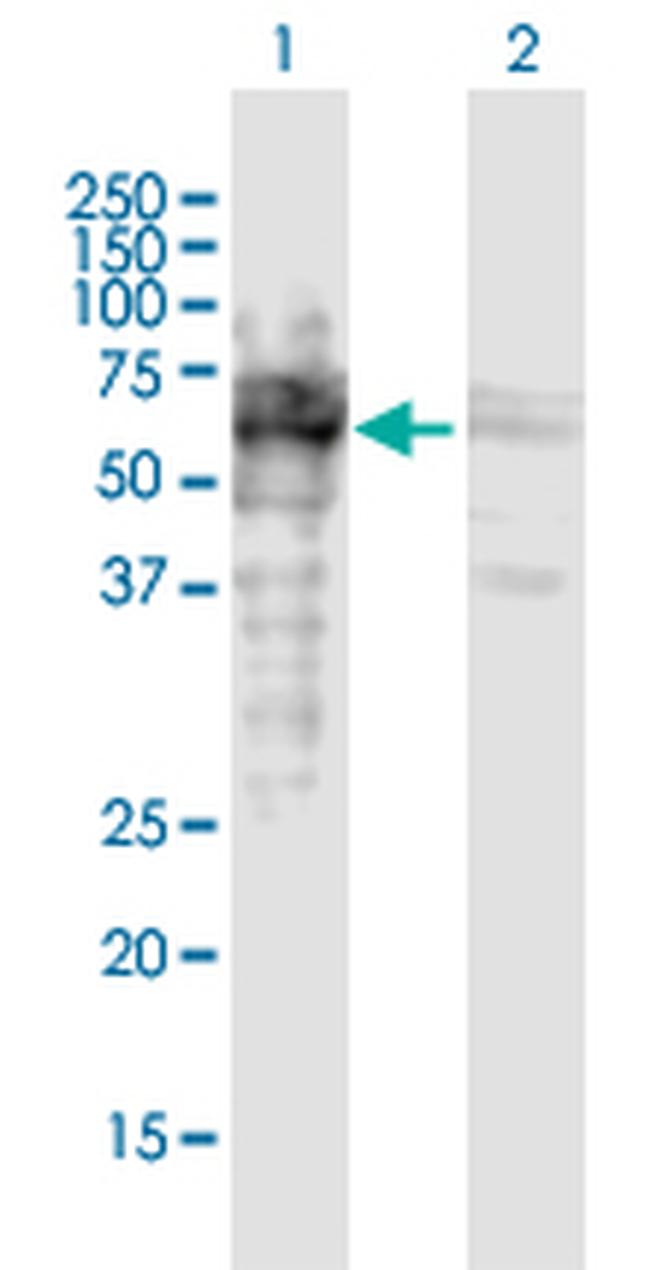 MAP2 Antibody in Western Blot (WB)