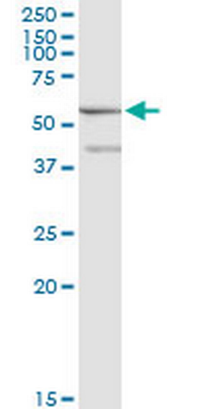 ME1 Antibody in Western Blot (WB)