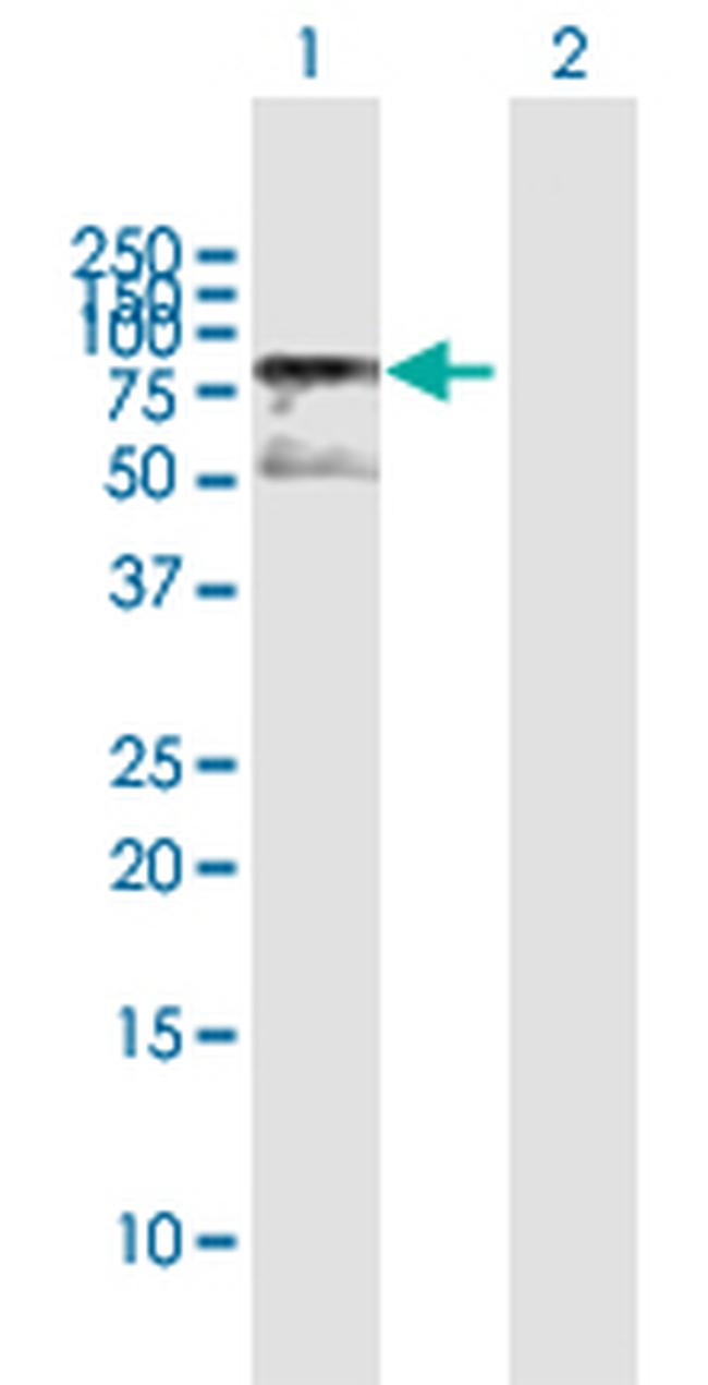 MECP2 Antibody in Western Blot (WB)