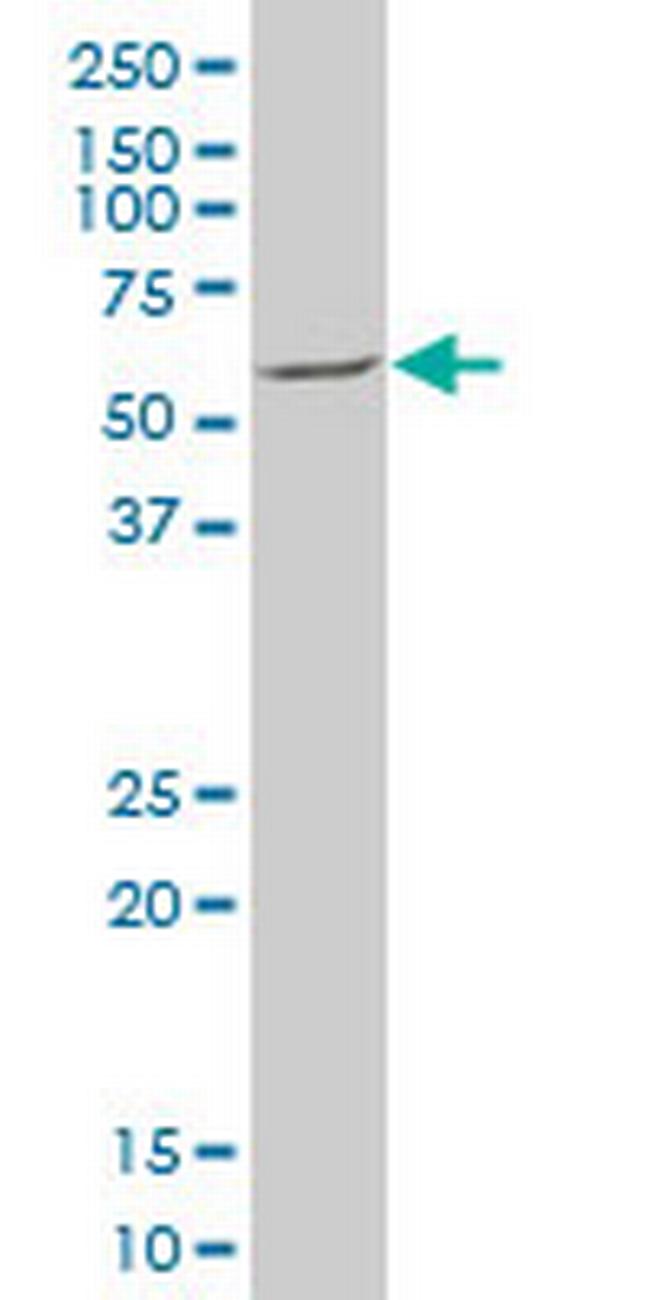 MEF2D Antibody in Western Blot (WB)