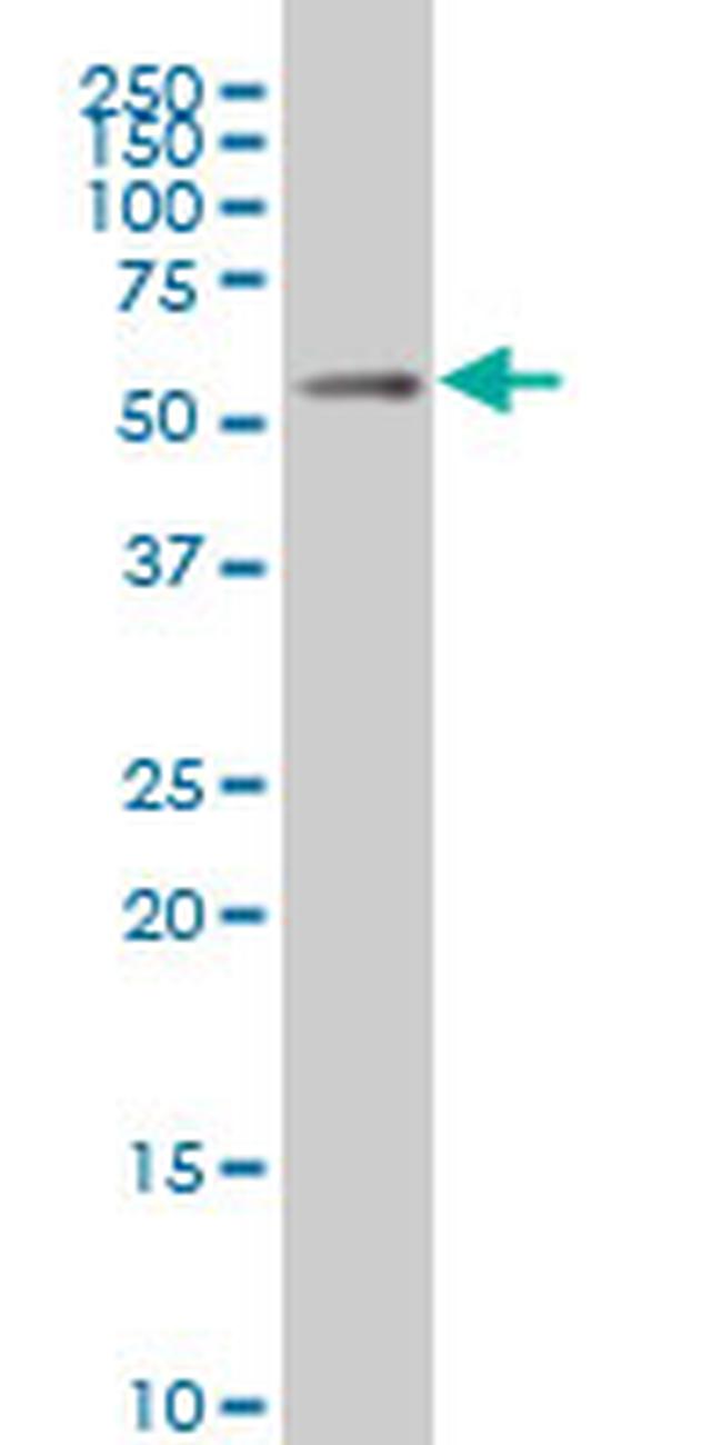 MEIS2 Antibody in Western Blot (WB)