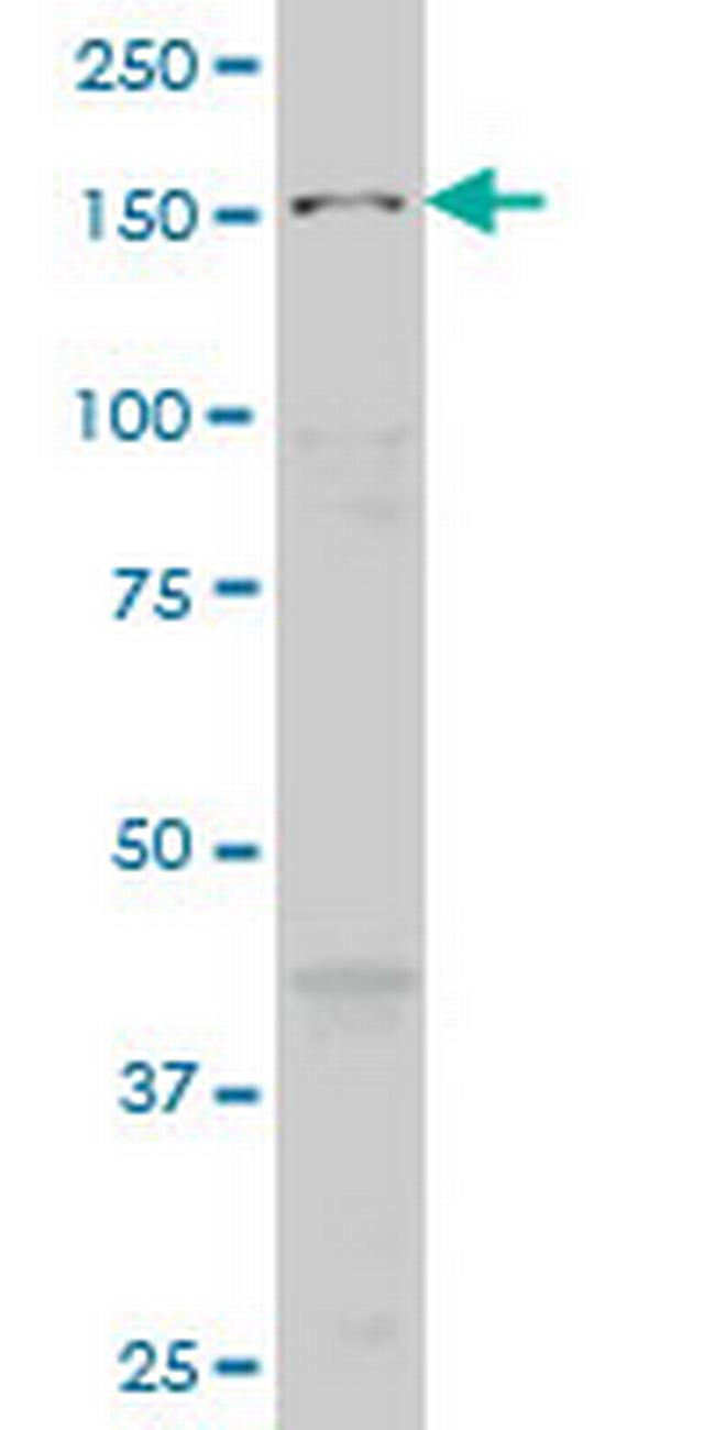 MAP3K5 Antibody in Western Blot (WB)