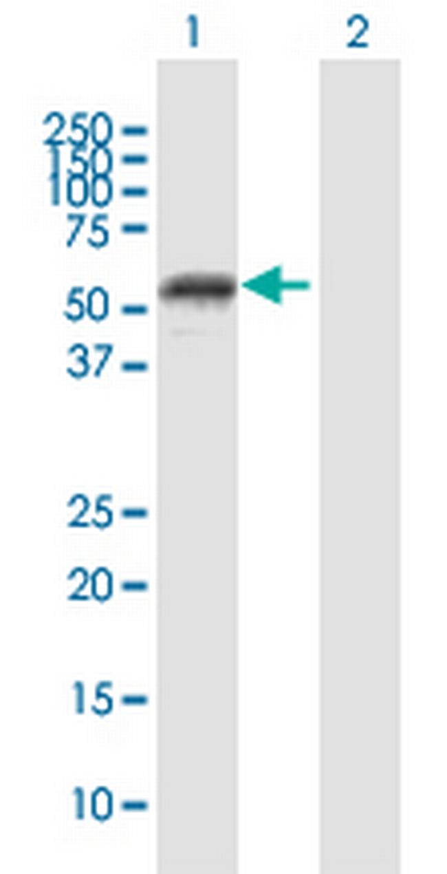 MMP1 Antibody in Western Blot (WB)