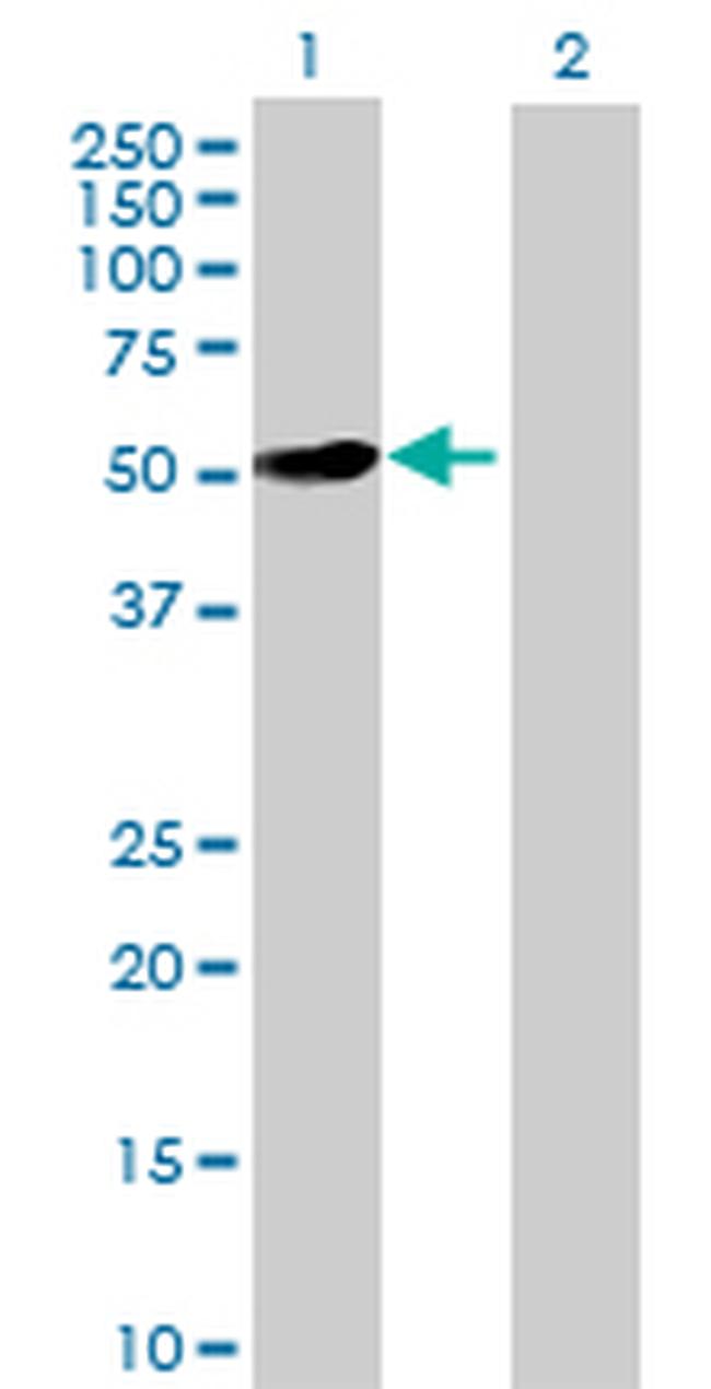 MMP10 Antibody in Western Blot (WB)