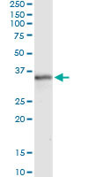 MSX1 Antibody in Immunoprecipitation (IP)