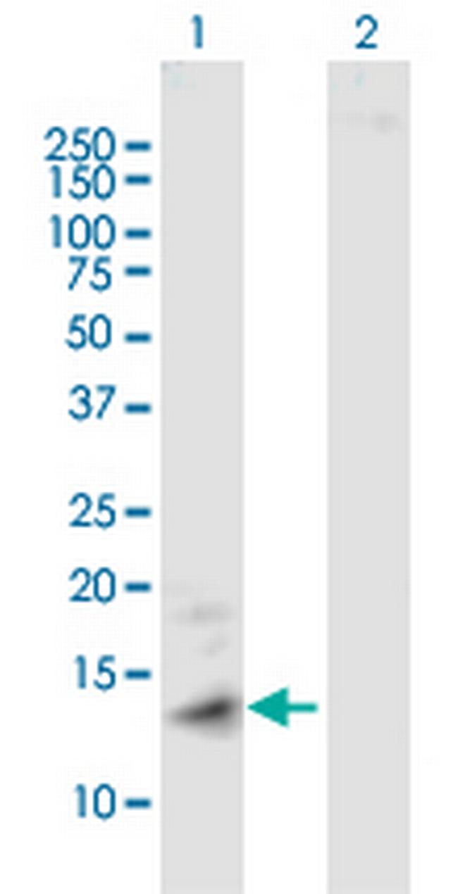 MT1A Antibody in Western Blot (WB)