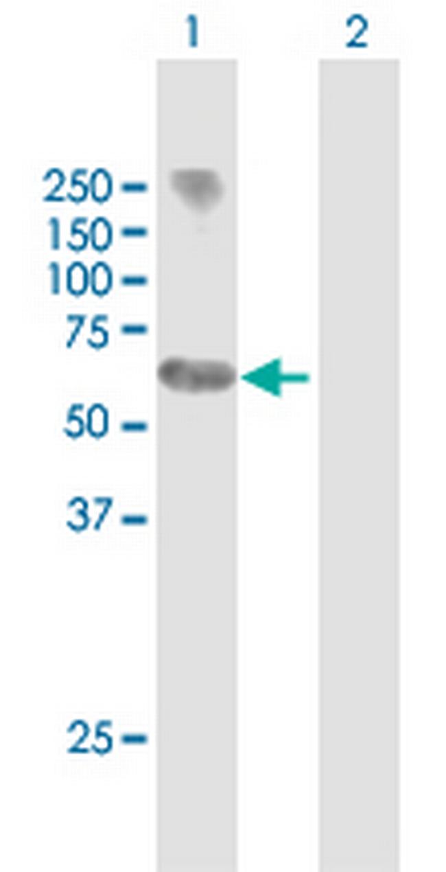 MYCN Antibody in Western Blot (WB)