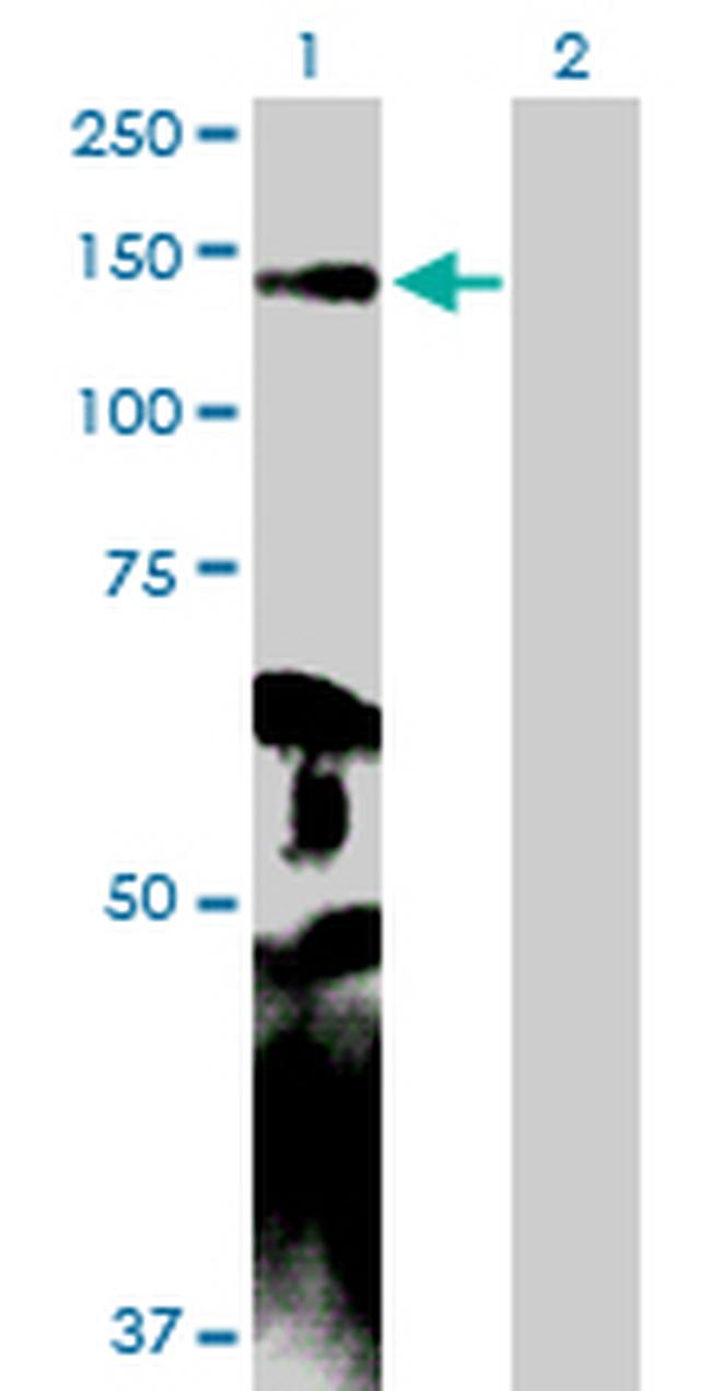 MYLK Antibody in Western Blot (WB)