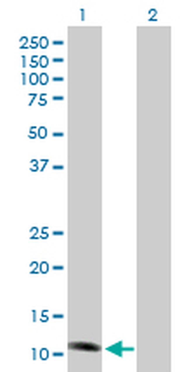 NDUFS6 Antibody in Western Blot (WB)