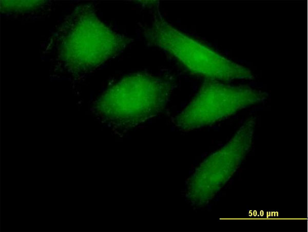 NEDD9 Antibody in Immunocytochemistry (ICC/IF)