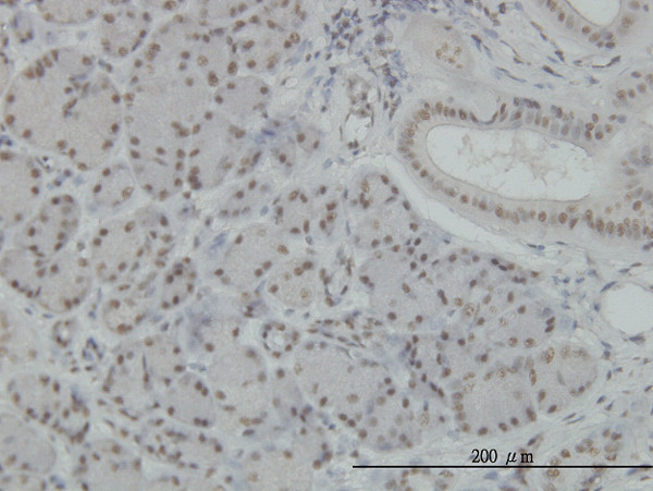 NFKB1 Antibody in Immunohistochemistry (Paraffin) (IHC (P))