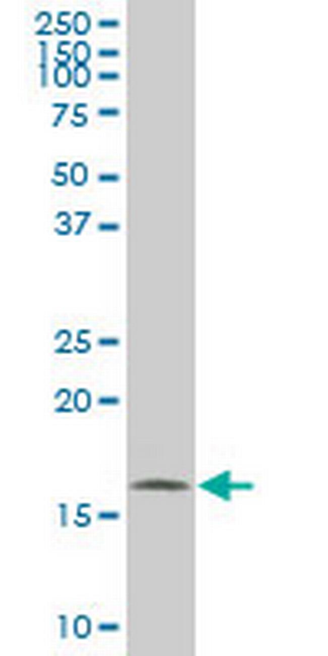 NME2 Antibody in Western Blot (WB)