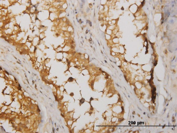 NME2 Antibody in Immunohistochemistry (Paraffin) (IHC (P))