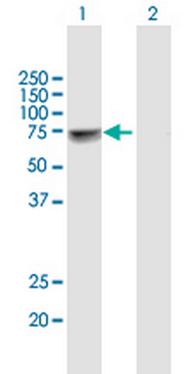 NUP98 Antibody in Western Blot (WB)