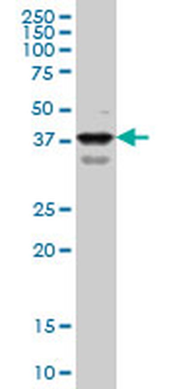 PBX1 Antibody in Western Blot (WB)