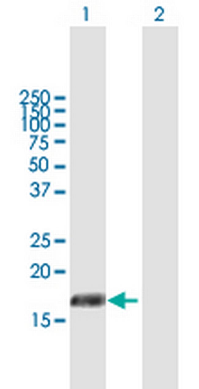 PIGH Antibody in Western Blot (WB)