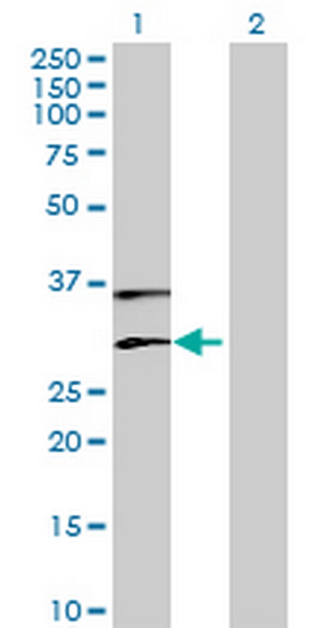 PLA2G1B Antibody in Western Blot (WB)